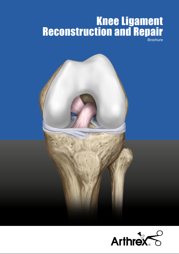 Knee Ligament Reconstruction and Repair Brochure