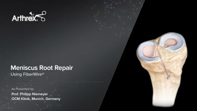 VID2-00955-EN_Meniscus_root_repair